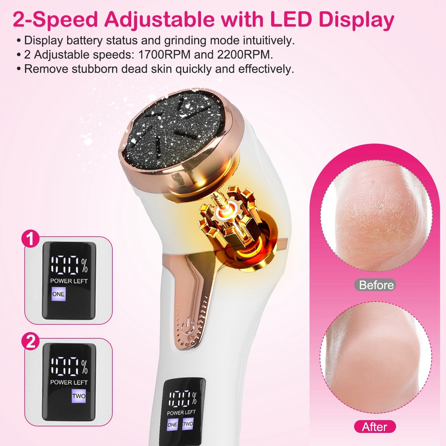 17Pcs Electric Foot Callus Remover With Vacuum Foot Grinder